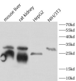      anti-Cathepsin B antibody