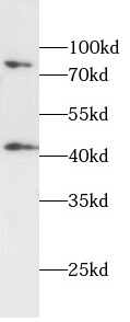 androgen receptor 抗体