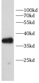 anti-GREM1 antibody