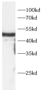 anti-Amphiregulin antibody