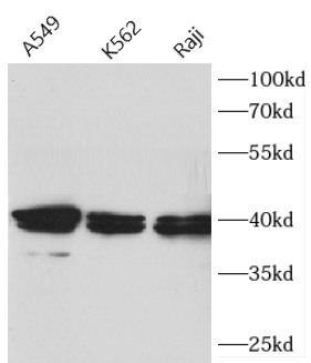      anti-APTX antibody