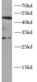      anti-ARY2 antibody