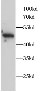      anti-AP2M1 antibody