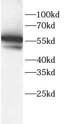      anti-ALPL antibody