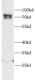      anti-PCSK4 antibody