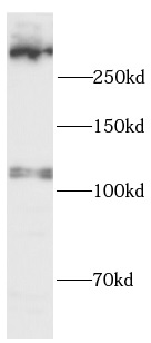      anti-UTRO antibody