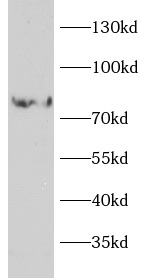 anti-VNN1 antibody