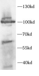      anti-CHM antibody