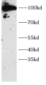      anti-DTL antibody