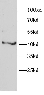      anti-A1BG antibody