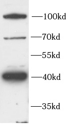 anti-FZD4 antibody