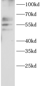      anti-ABCE1 antibody