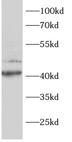      anti-AKT1S1 antibody