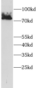      anti-ECD antibody