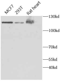 anti-HK1 antibody