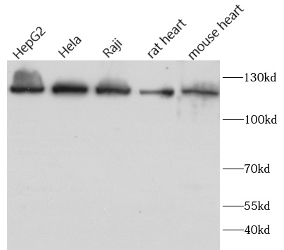 ATP citrate lyase抗体