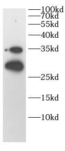 anti-TIGAR antibody