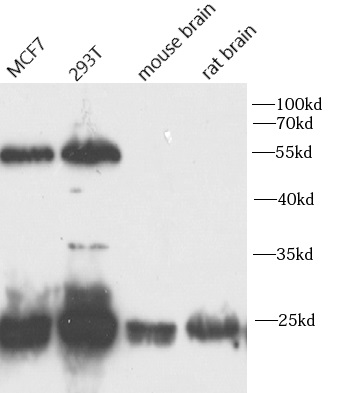 anti-EIF4E antibody