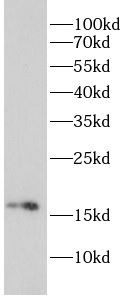      anti-RHEB antibody