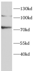 anti-LIPE antibody