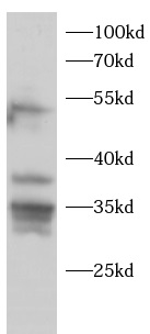 anti-p38 antibody