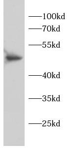 anti-NFKB1 antibody