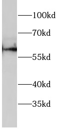      anti-SGK1 antibody