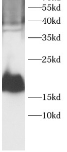      anti-4EBP1 antibody