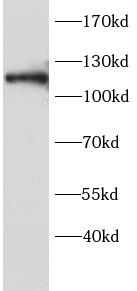      anti-HIF1a antibody