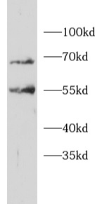 anti-ITCH antibody