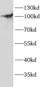 anti-ITCH antibody