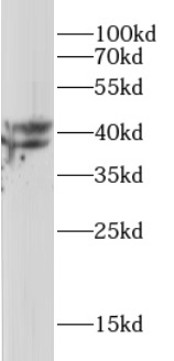      anti-PP1A antibody