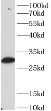 anti-PPP1CB antibody