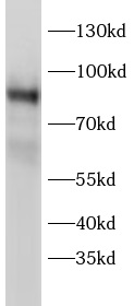      anti-PRKCH antibody