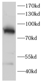      anti-PRKCG antibody