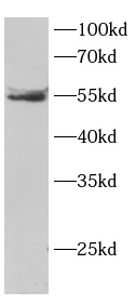      anti-MYD88 antibody