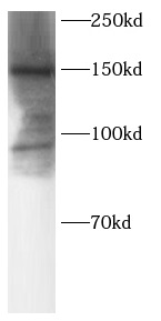 anti-SOS2 antibody