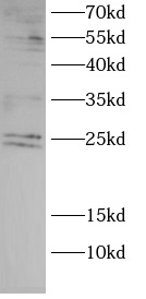 anti-GRB2 antibody