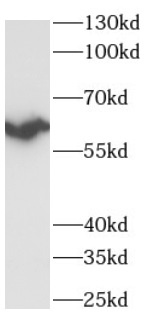 anti-RPS6KB2 antibody