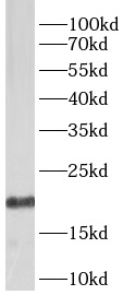      anti-BCL2L2 antibody