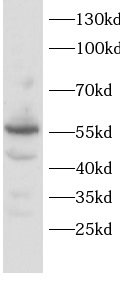      anti-PTGIS antibody