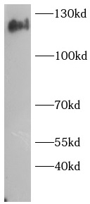      anti-TRIAD3A antibody