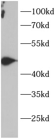 anti-PTP1B antibody