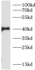 anti-TNFAIP3 antibody