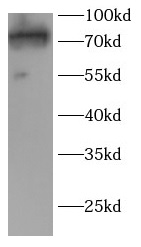 anti-TAB2 antibody