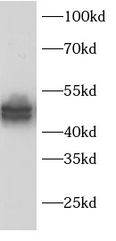      anti-IKBKG antibody