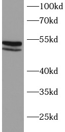 anti-MKK7 antibody