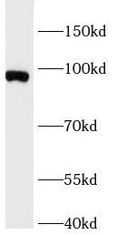 anti-FOXO3A antibody