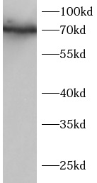      anti-IRAK1 antibody