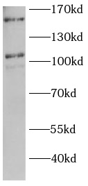      anti-HYOU1 antibody